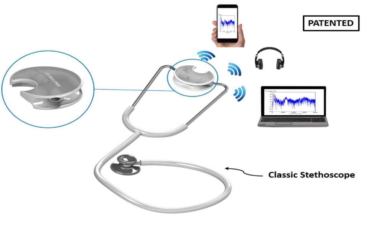 Stethotelephone, il progetto di un giovane calabrese per unire stetoscopio e smartphone