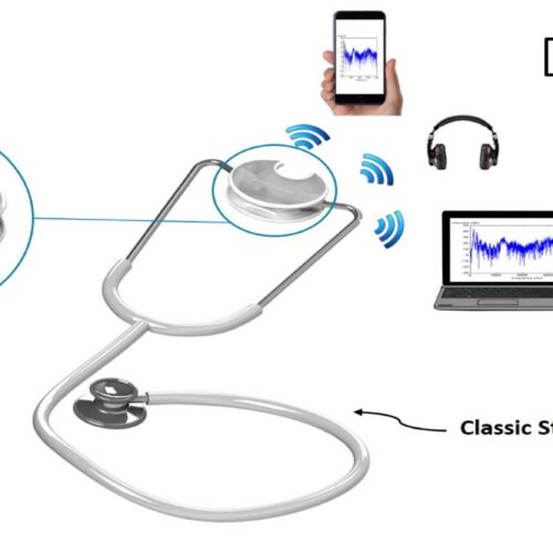 Stethotelephone, il progetto di un giovane calabrese per unire stetoscopio e smartphone