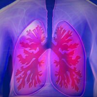Tumore al polmone, 1,5 milioni di morti ogni anno nel mondo