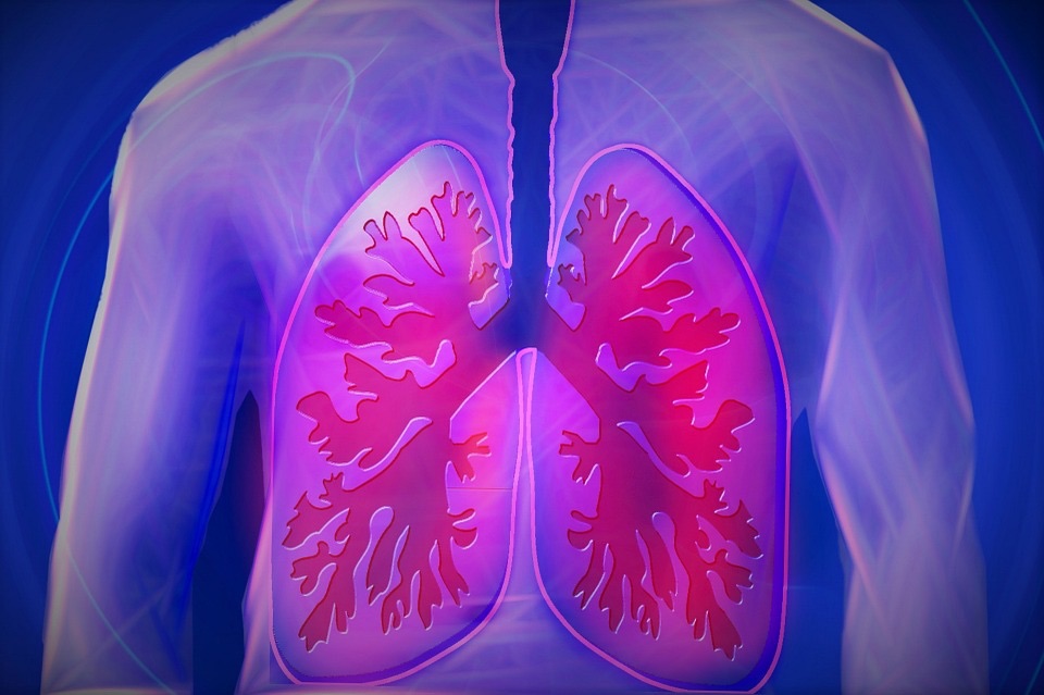 Tumore al polmone, 1,5 milioni di morti ogni anno nel mondo
