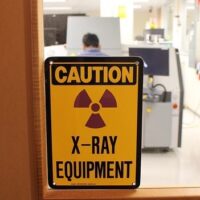 Radiografie a neonati prematuri. Troppi rischi