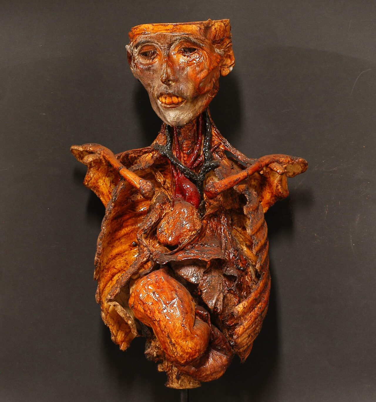 Busto tannizzato con Situs inversus viscerorum. Foto tratta dal sito Museo di storia della medicina (http://reperti.musme.padova.it/Reperti.aspx)Destrocardia. 