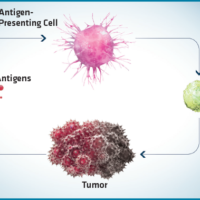 Tumore del Rene: immuno-oncologia aumenta del 27% la sopravvivenza