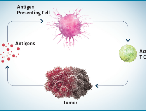 Tumore del Rene: immuno-oncologia aumenta del 27% la sopravvivenza