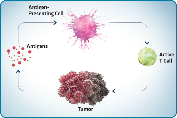 Tumore del Rene: immuno-oncologia aumenta del 27% la sopravvivenza