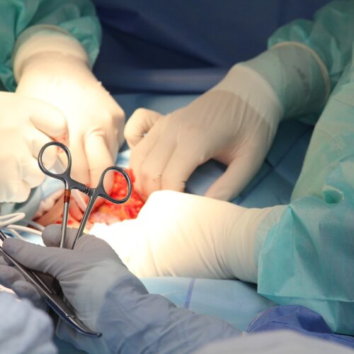 Aorta addominale, per rottura 6mila decessi l’anno in Italia. L’80% muore prima dell’arrivo in ospedale