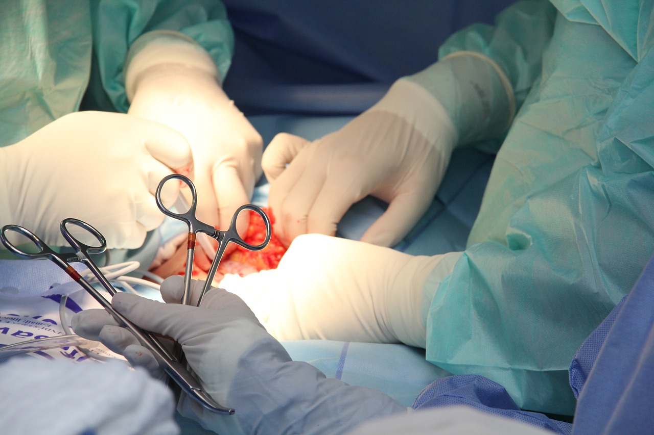 Aorta addominale, per rottura 6mila decessi l’anno in Italia. L’80% muore prima dell’arrivo in ospedale