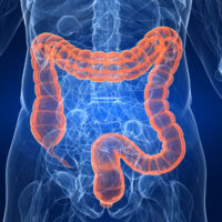 Nuove prospettive di cura per i pazienti con tumore al colon