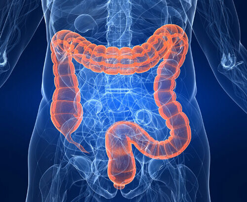 Nuove prospettive di cura per i pazienti con tumore al colon