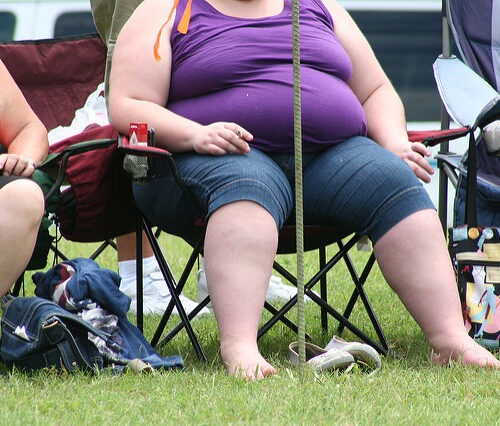 Sedentarietà e obesità sono malattie sociali