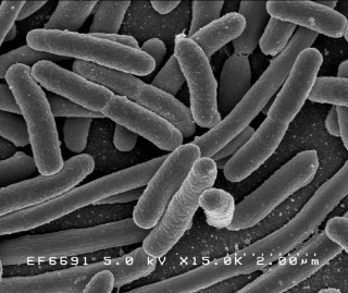 Escherichia coli: Scanning electron micrograph. Credit: Rocky Mountain Laboratories, NIAID, NIH -