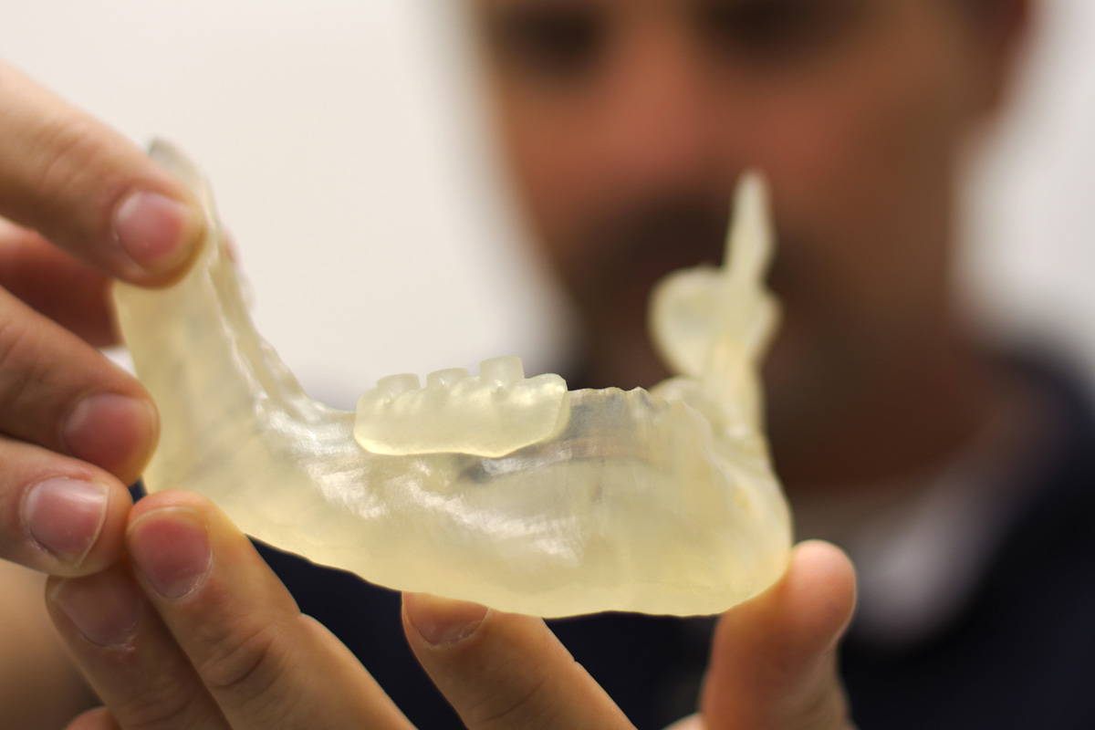 Exposanità: La stampa 3D incontra la medicina