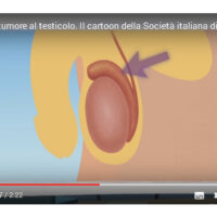 Cancro al testicolo: è il più frequente in età giovanile