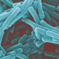 I Lactobacillus contro il tumore al seno