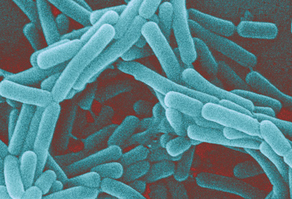 I Lactobacillus contro il tumore al seno