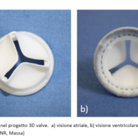 Dalla Toscana la valvola aortica di nuova generazione