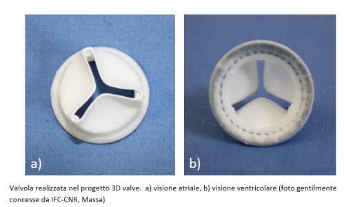 Dalla Toscana la valvola aortica di nuova generazione
