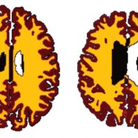 Il cervello di un oversize? E' più vecchio di 10 anni