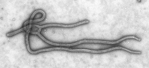 Virus Ebola. Fonte https://www.flickr.com/photos/hukuzatuna/