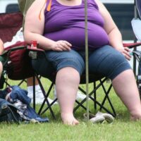 Obesità, esperti a istituzioni: sia inserita nei LEA