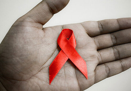 AIDS, Sosta Consigliata per il test HIV