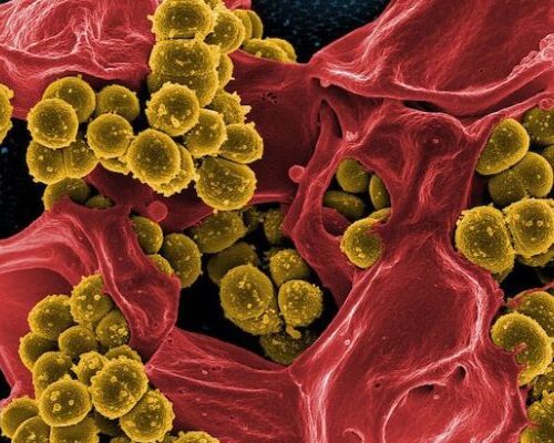 Potente e mirato, arriva in Italia super-antibiotico Zerbaxa