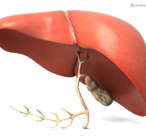 Osservatorio malattie rare: “Patologie del fegato poco riconosciute”