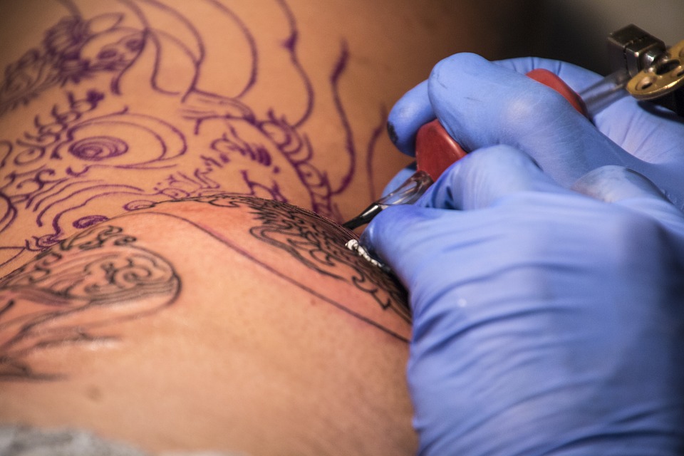 Quando dopo un tatuaggio compare la psoriasi