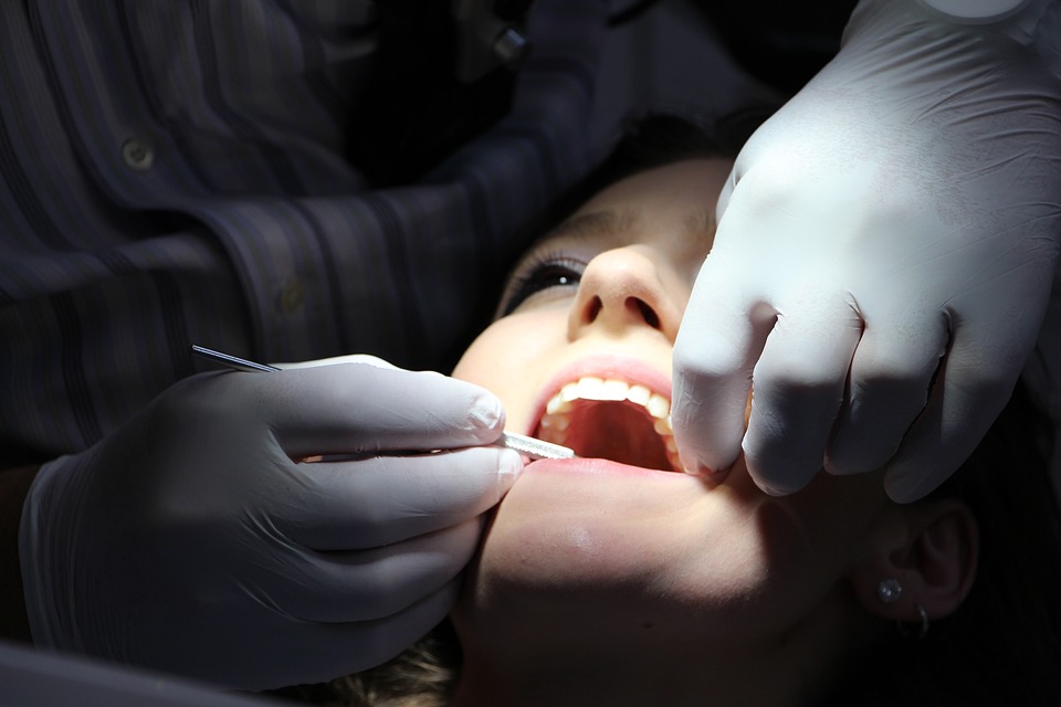 Detartrage dei denti almeno ogni 6 mesi per non rischiare gengiviti