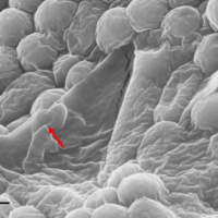 Con il "grafene" i superbatteri hanno preso un granchio