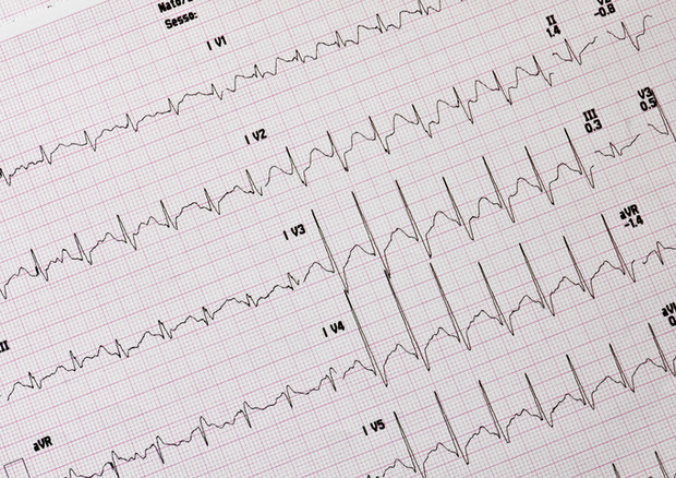 In pronto soccorso nuove tecniche per la diagnosi dell’infarto