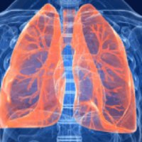 Tumore del polmone, immunoterapia e chemioterapia più efficaci se fatte insieme