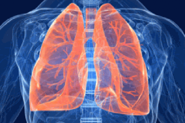 Tumore del polmone, immunoterapia e chemioterapia più efficaci se fatte insieme