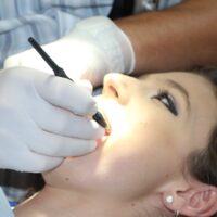 Parodontite, la malattia che può far cadere i denti