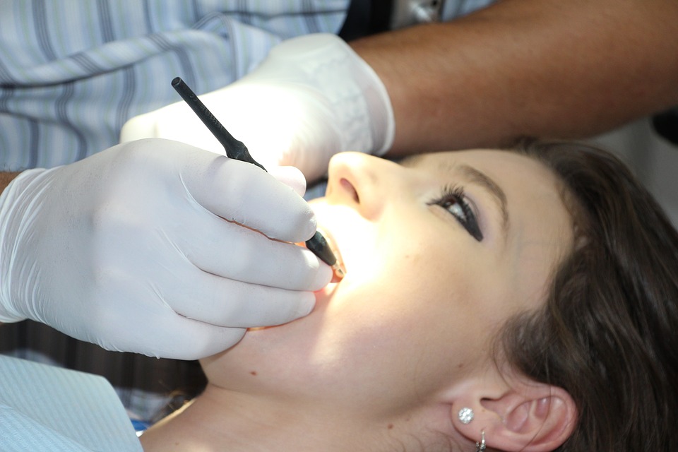 Parodontite, la malattia che può far cadere i denti