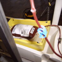 ISS: in Italia trasfusioni di sangue sicure