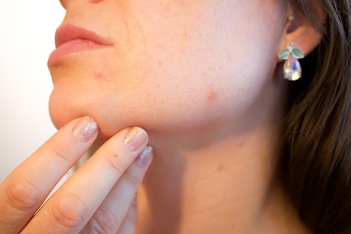 Arriva in Italia nuova tecnologia per la cura dell’acne