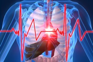 Infarti e ictus, con la prevenzione si evitano sempre di più ma aumentano i malati cronici