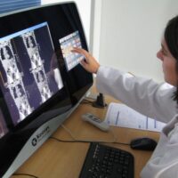 Osteoporosi e fratture fragilità: 8 società firmano nuove linee guida