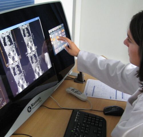 Osteoporosi e fratture fragilità: 8 società firmano nuove linee guida