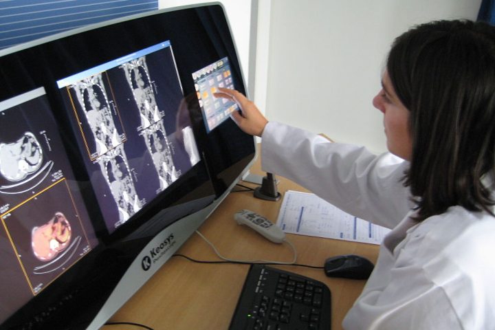 Osteoporosi e fratture fragilità: 8 società firmano nuove linee guida