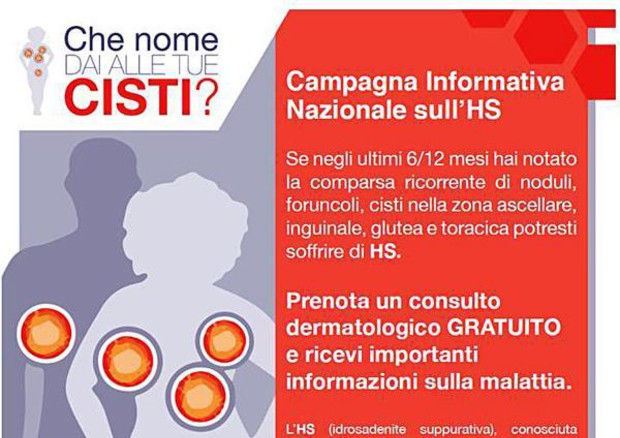 Idrosadenite Suppurativa (HS). Al via campagna informazione ‘Che nome dai alle tue cisti?’