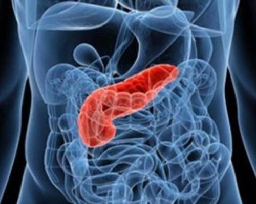 Tumore pancreas, Reni (San Raffaele): “Progressi con nuove terapie”