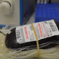 Donazioni di sangue: gestite in sicurezza nonostante le epidemie