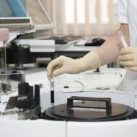 Tumore prostata, nuovo test su PSA brevettato dall'Istituto Superiore di Sanità