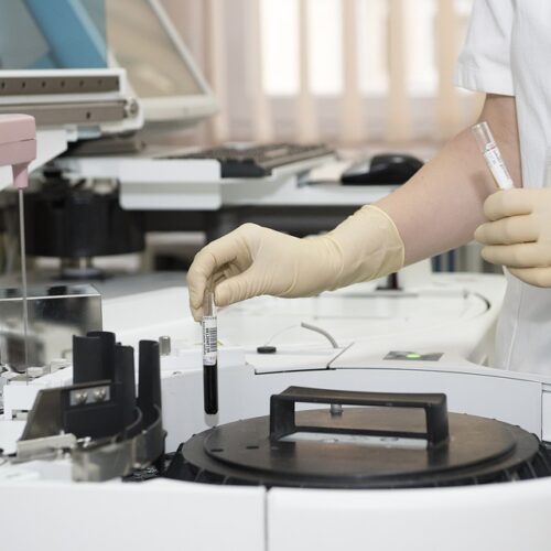 Tumore prostata, nuovo test su PSA brevettato dall’Istituto Superiore di Sanità