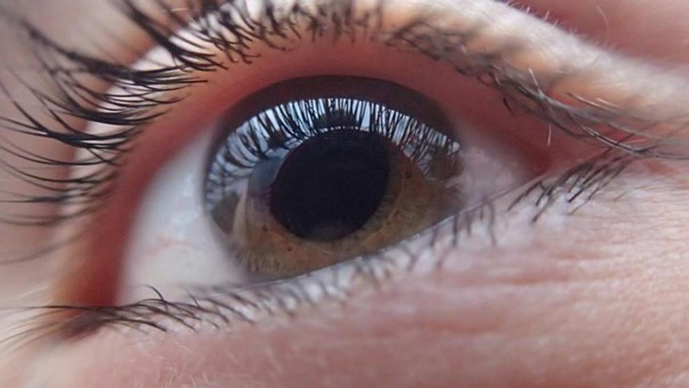 Glaucoma, male strisciante che ruba la vista a poco a poco: come prevenirlo