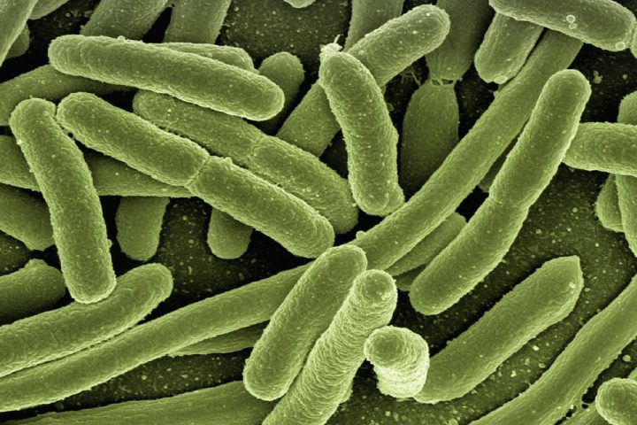 koli-bacteria-123081_960_720
