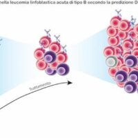 Leucemia: studio italo-americano su cellule che fin dalla diagnosi predicono possibili recidive