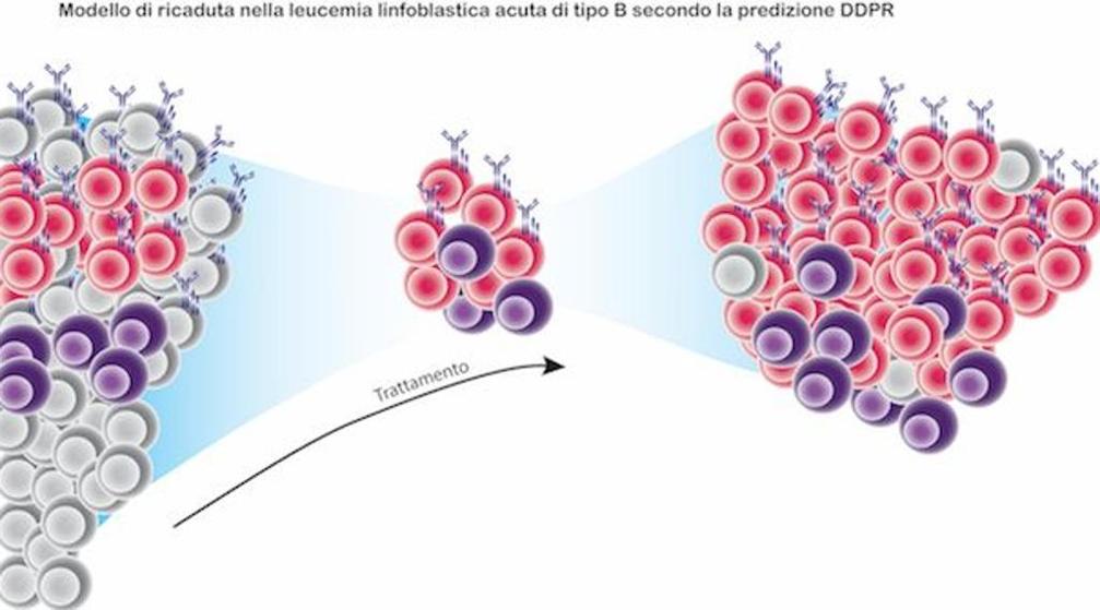 Leucemia: studio italo-americano su cellule che fin dalla diagnosi predicono possibili recidive